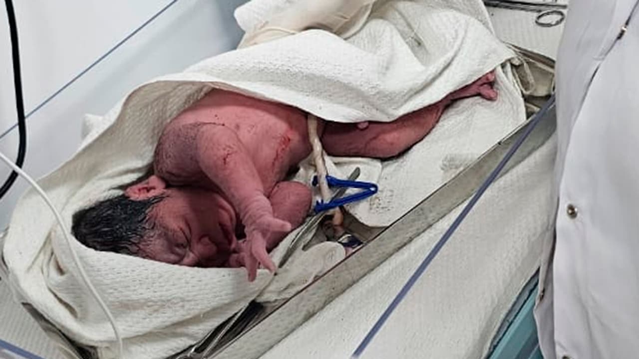 first woman delivery happened at central hospital established in prayagraj mahakumbh 2025 mela first woman delivery happened at central hospital established in prayagraj mahakumbh 2025 mela