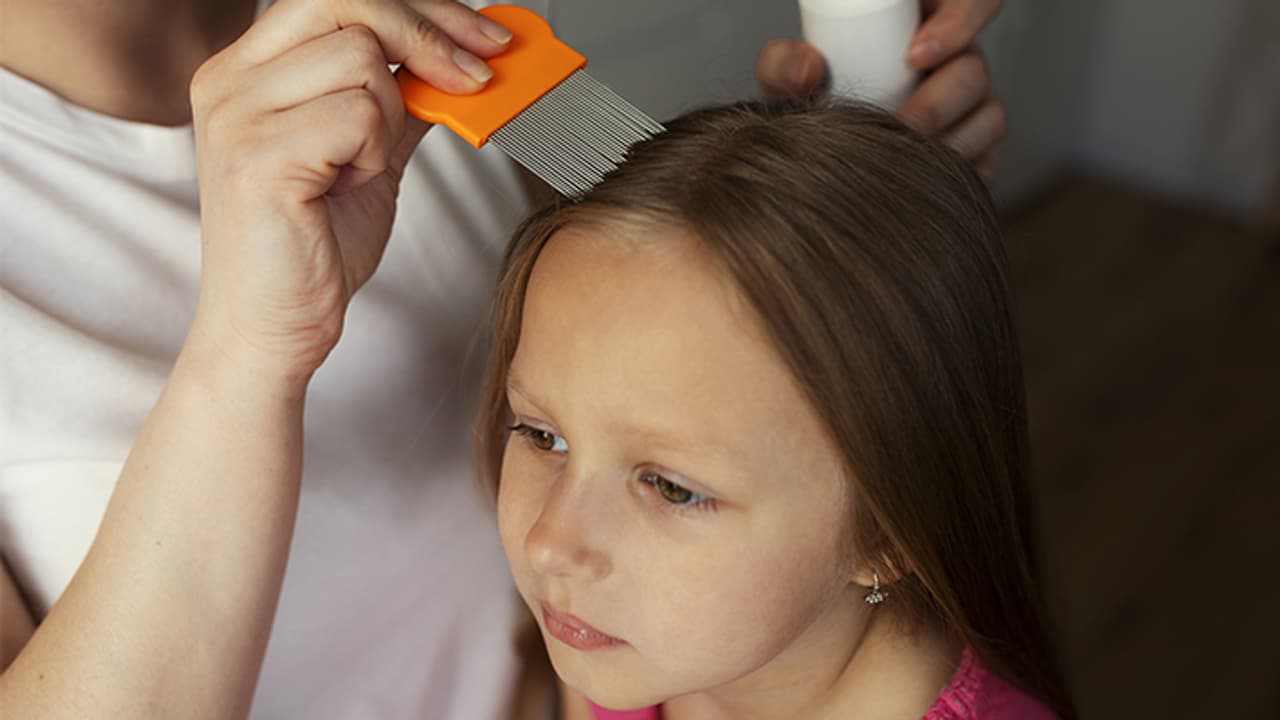 How to get rid of lice from kids hair