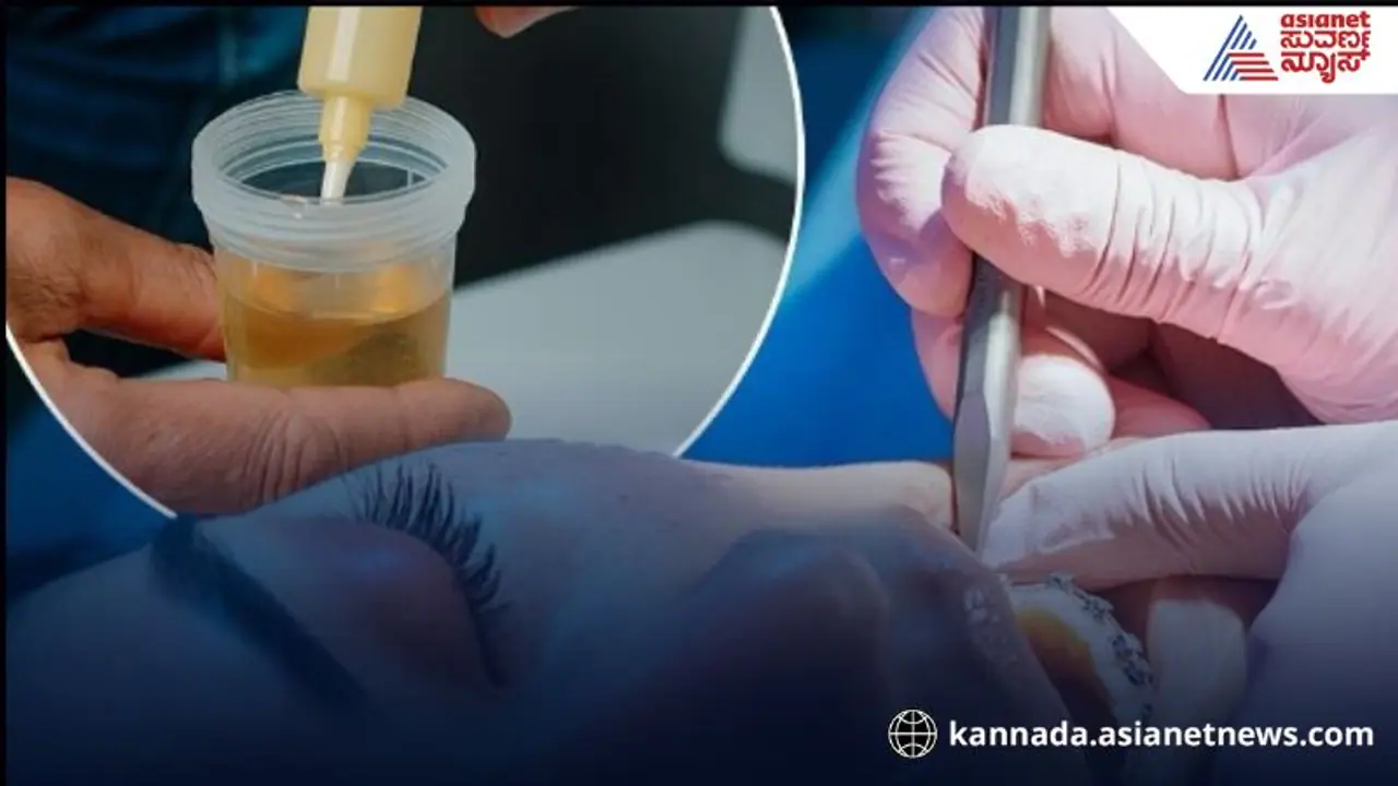 Human urine Human urine