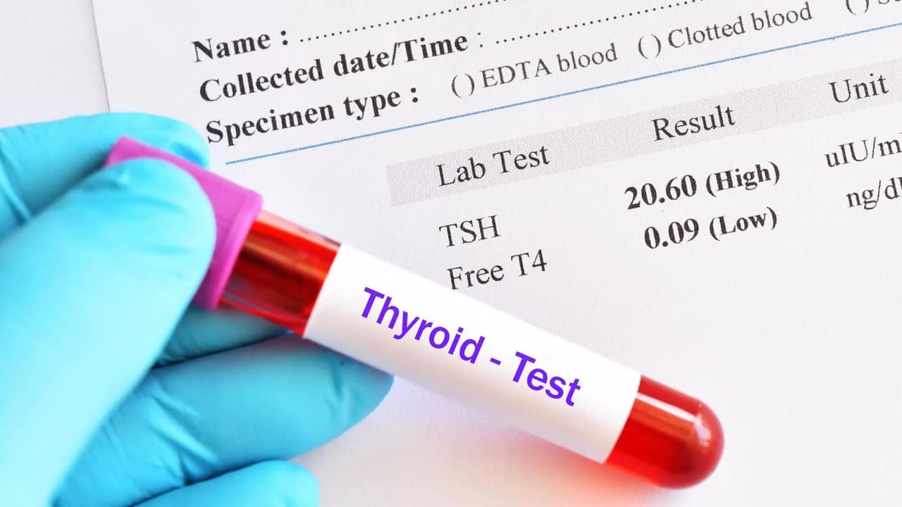 Thyroid Test Thyroid Test