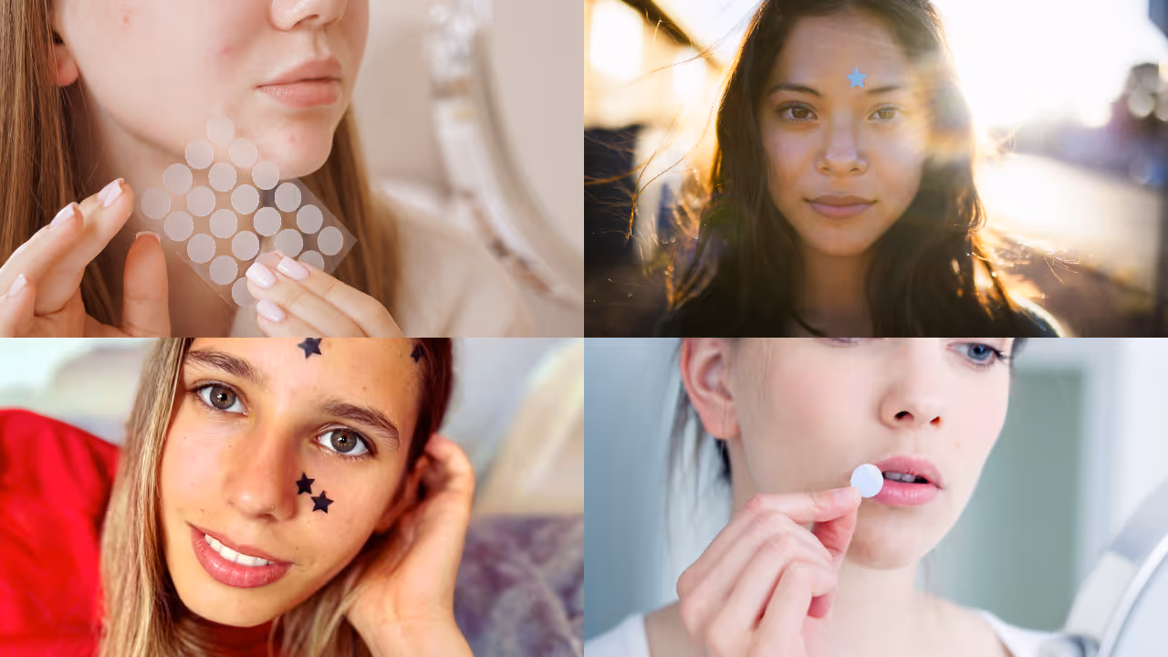 pimple patches pimple patches