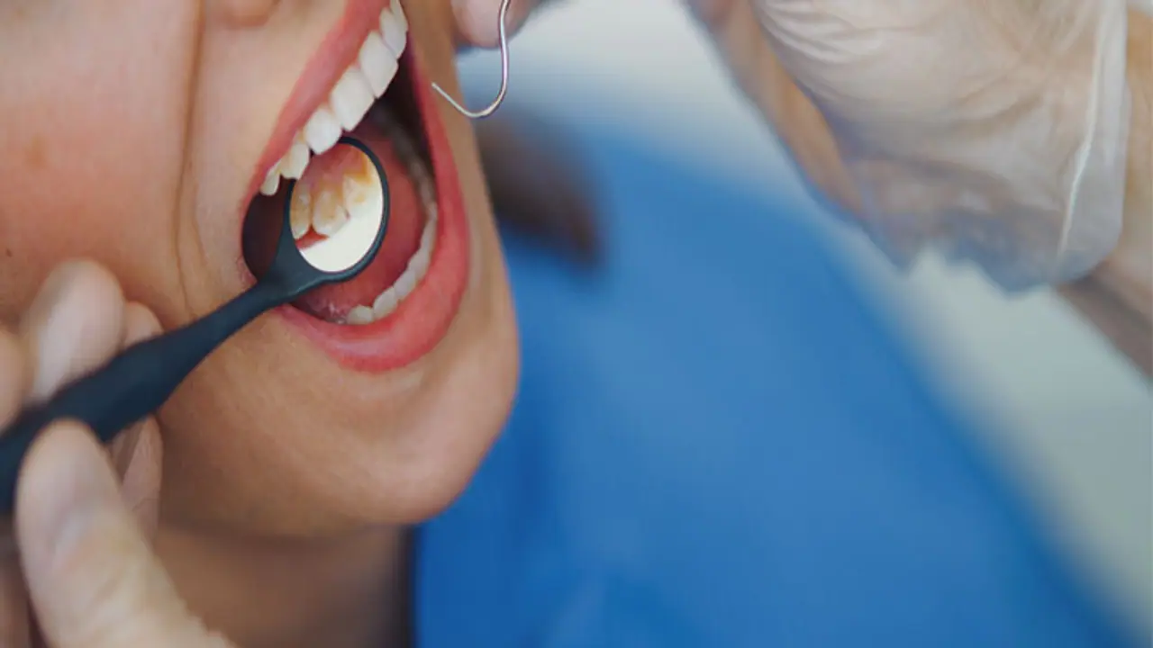 oral cancer oral cancer