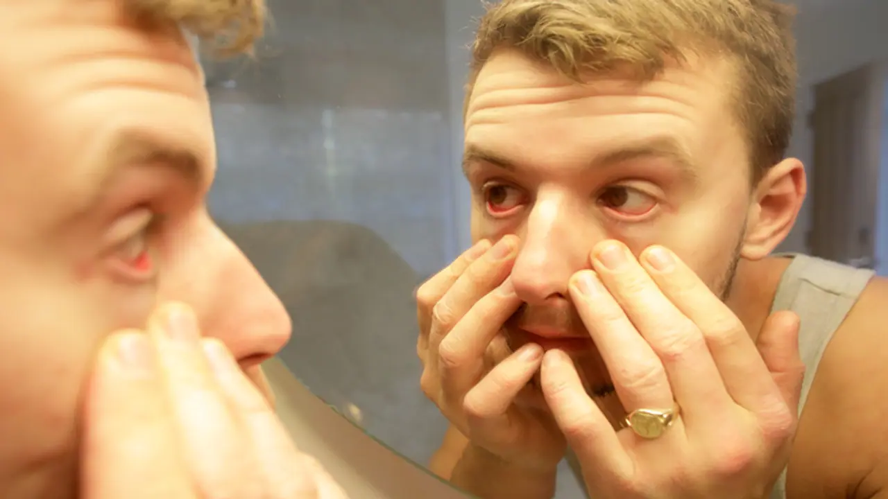 eye care in hindi eye care in hindi