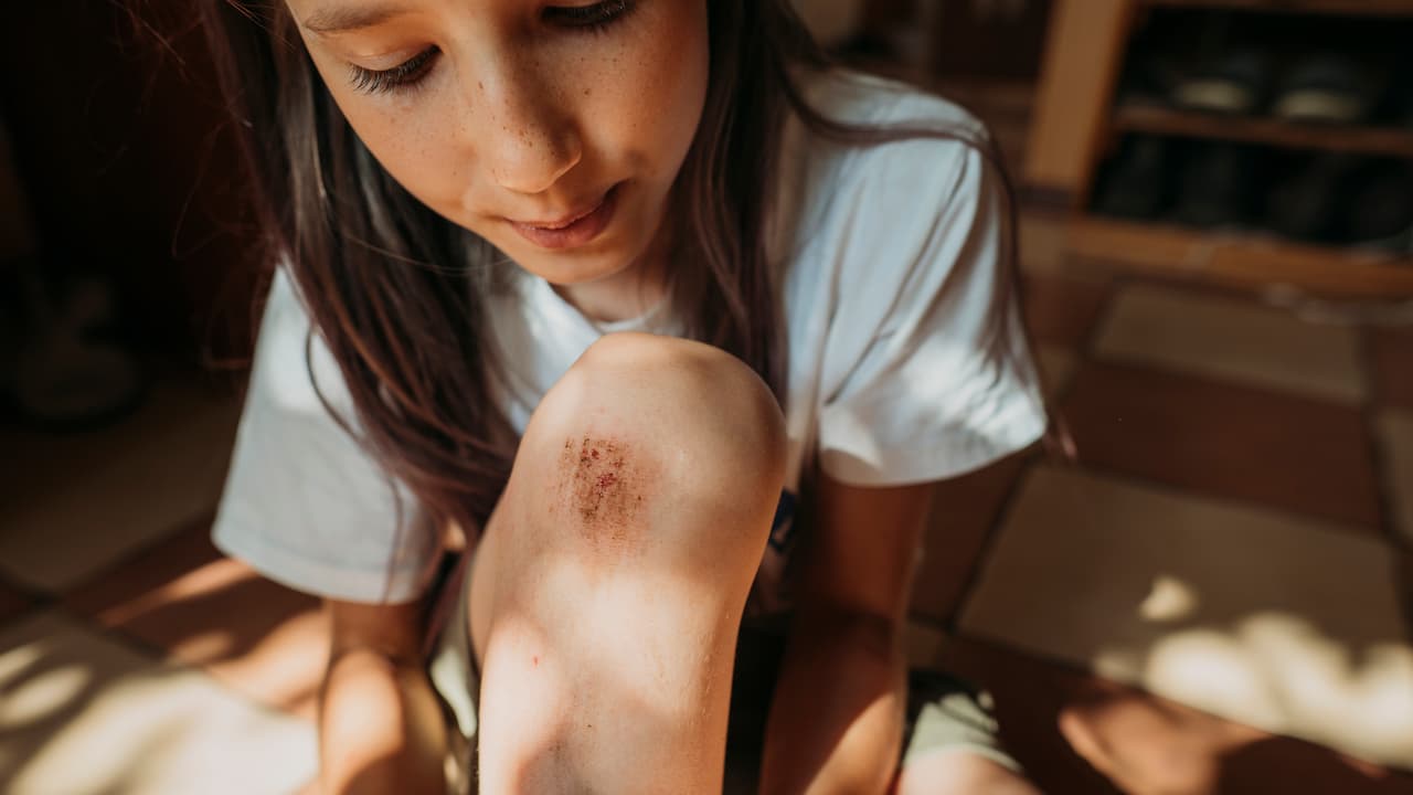 Wound Care Wound Care