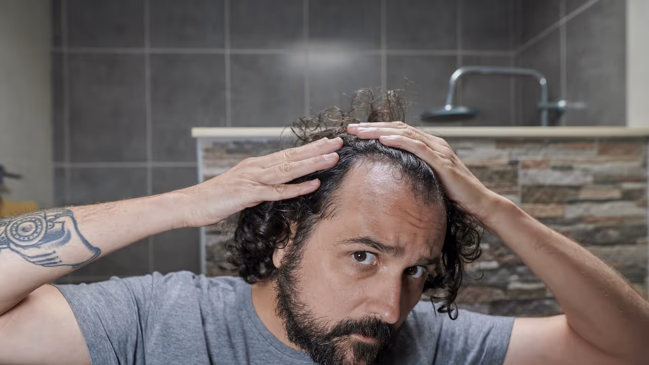 Stevia compound boosts minoxidil absorption and hair growth