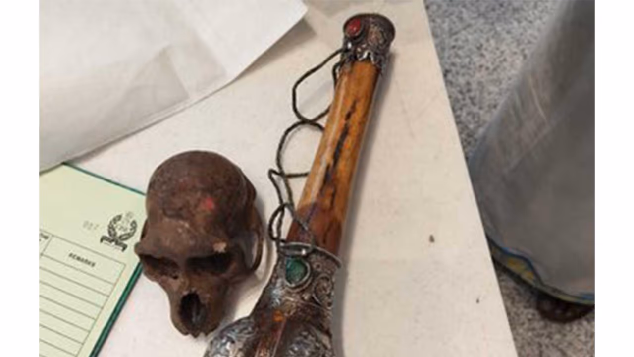Passenger with Skull in Hand Luggage Detained at Delhi IGI Airport Passenger with Skull in Hand Luggage Detained at Delhi IGI Airport
