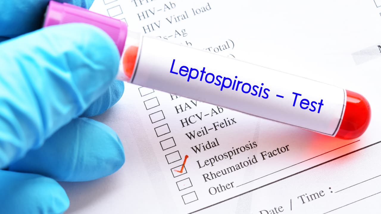 Leptospirosis