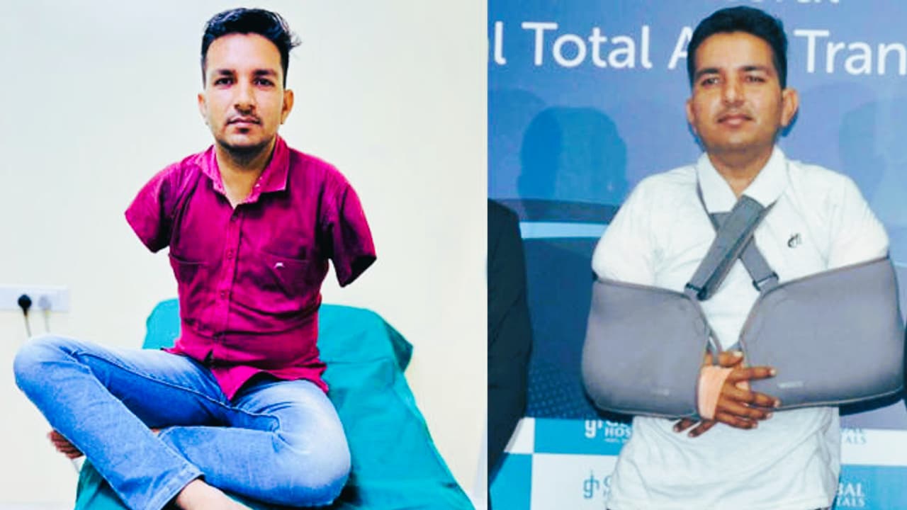 Rajasthan man becomes first Asian to undergo total arm transplant Rajasthan man becomes first Asian to undergo total arm transplant
