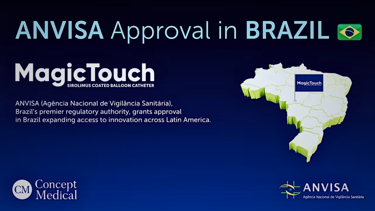 MagicTouch Brazil Approval: 5 Reasons This Breakthrough Redefines Cardiac Care