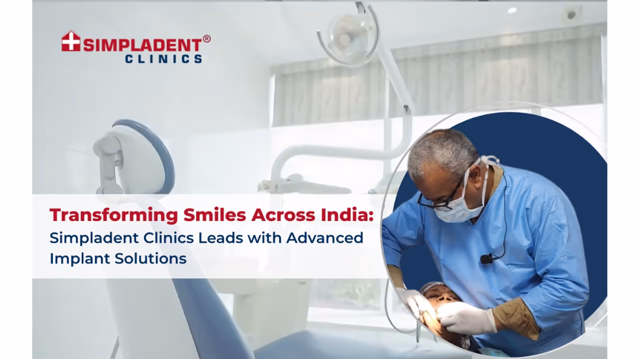 Transforming Smiles Across India: Simpladent Clinics Leads with Advanced Implant Solutions Transforming Smiles Across India: Simpladent Clinics Leads with Advanced Implant Solutions