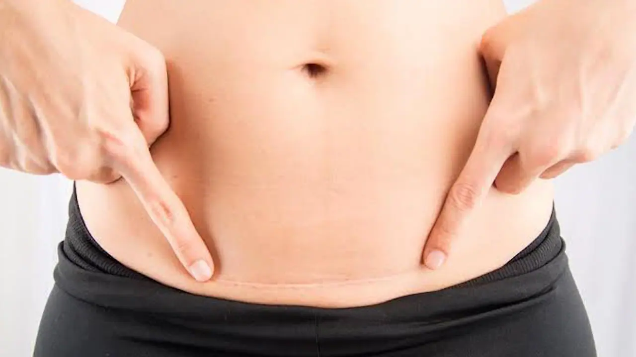 Healing After C Section: Essential Products and Tips for Indian Moms