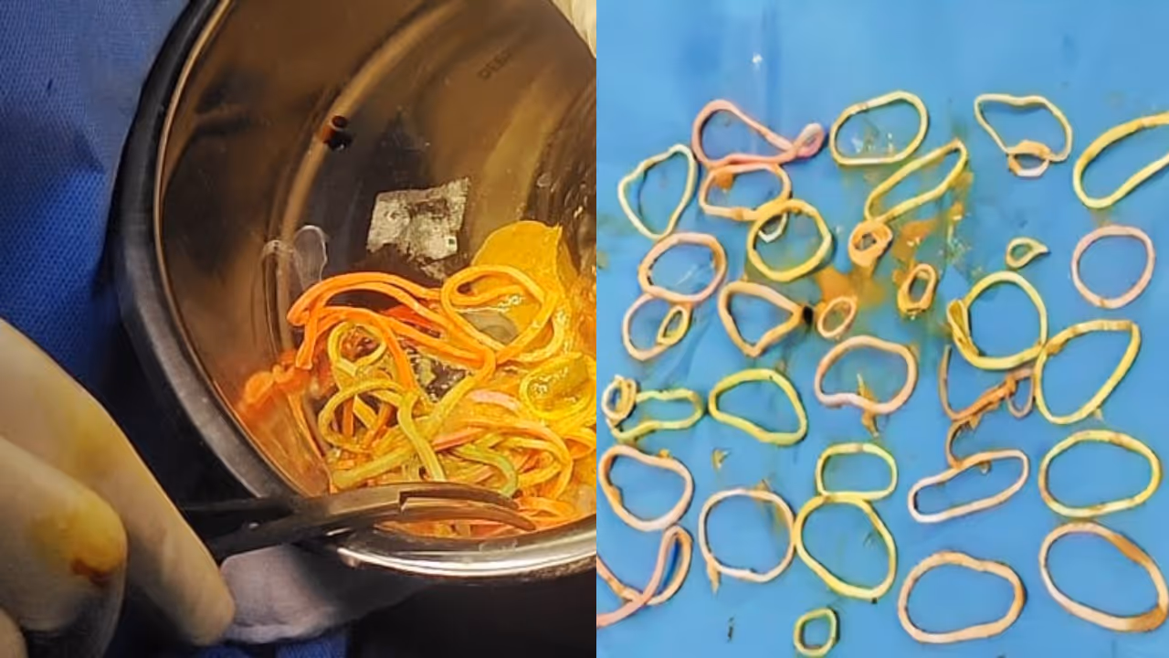 Rubber band Rubber band