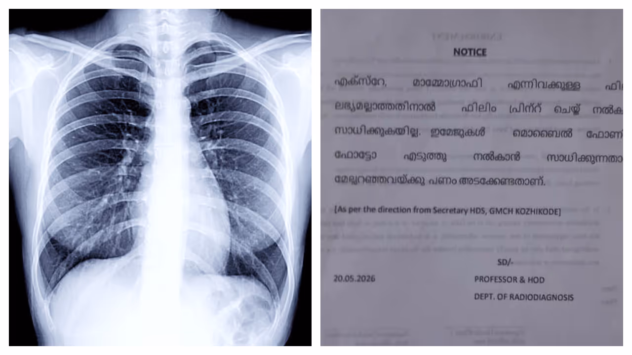 Kozhikode Medical College Kozhikode Medical College
