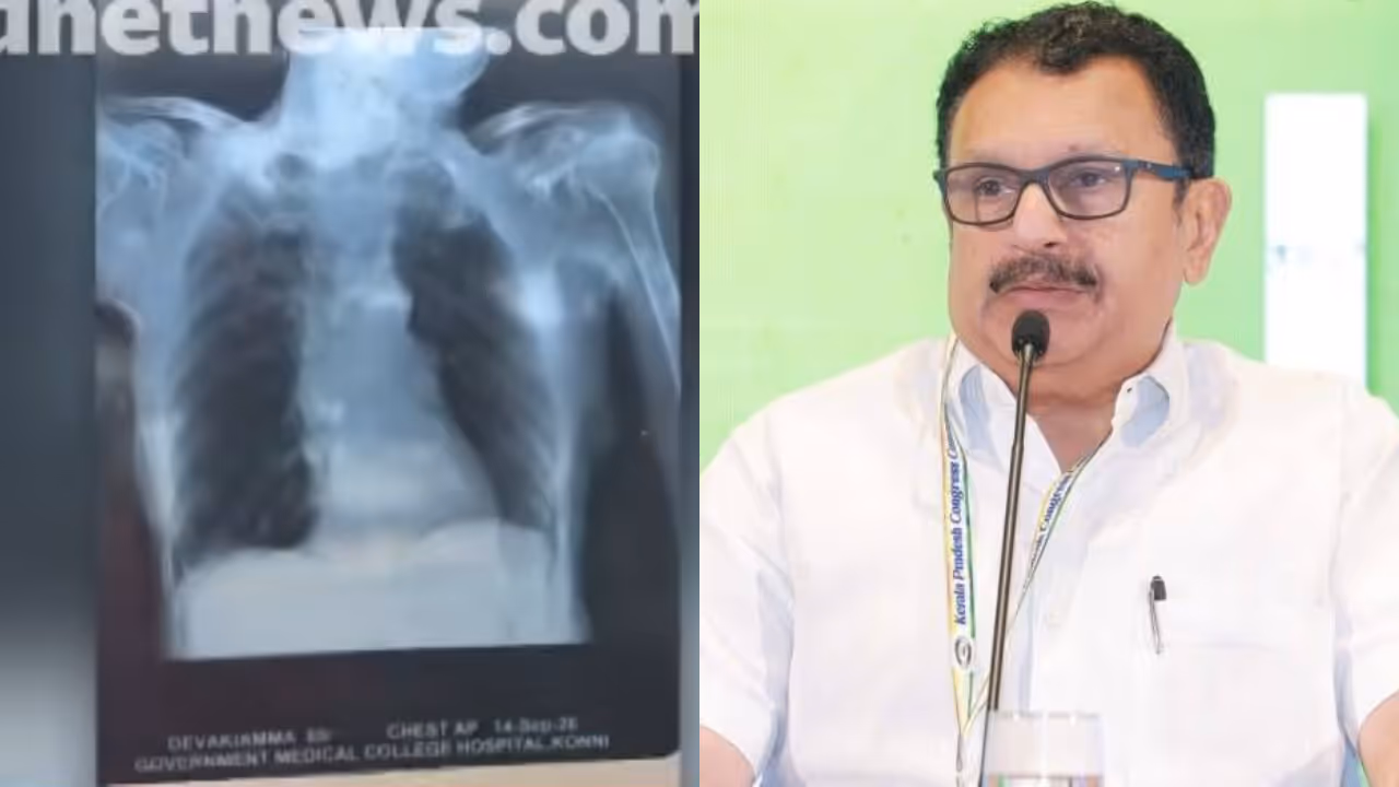konni medical college xray issue konni medical college xray issue