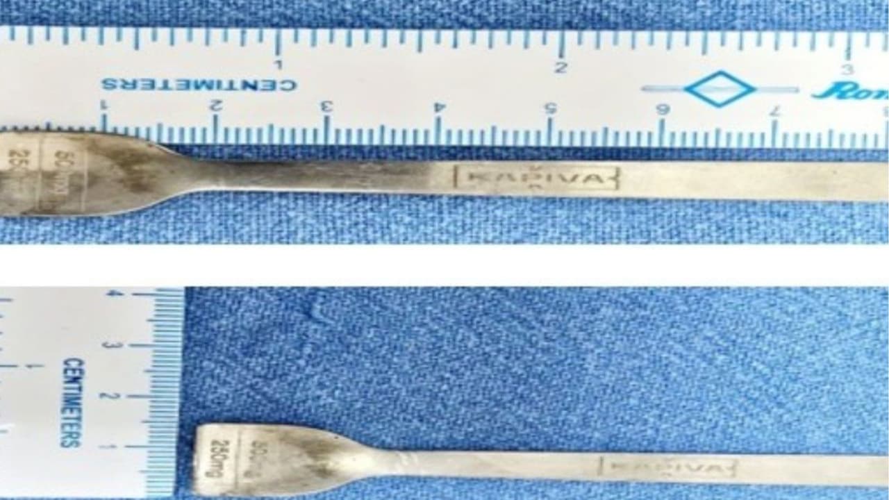 युवक ने पानी के साथ निगल लिया चम्मच युवक ने पानी के साथ निगल लिया चम्मच