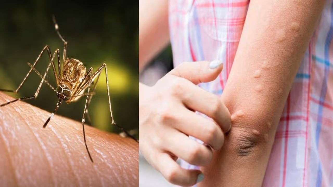 Japanese Encephalitis Fear