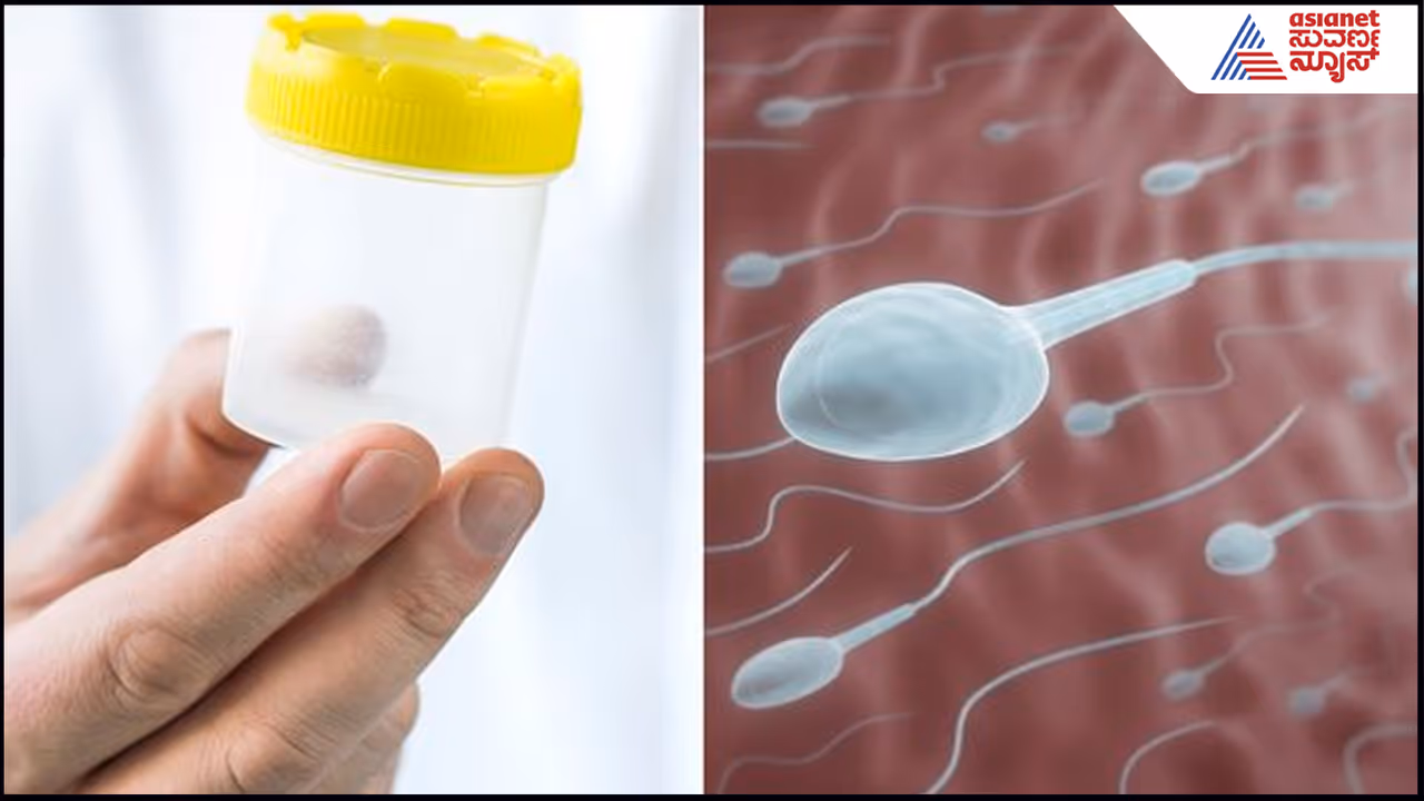 Sperm Donation