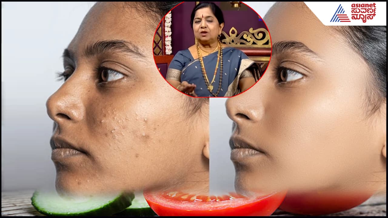 Ayurvedic tips for dark spots