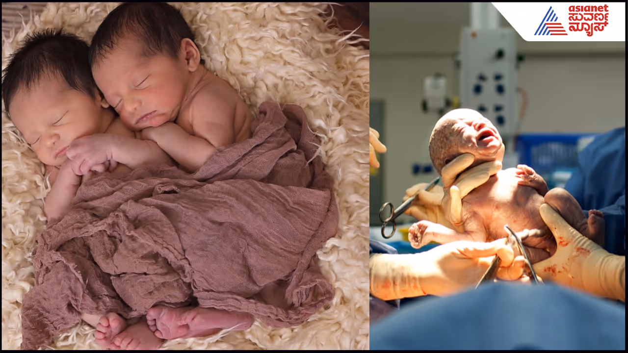 Representative Picture of Babies