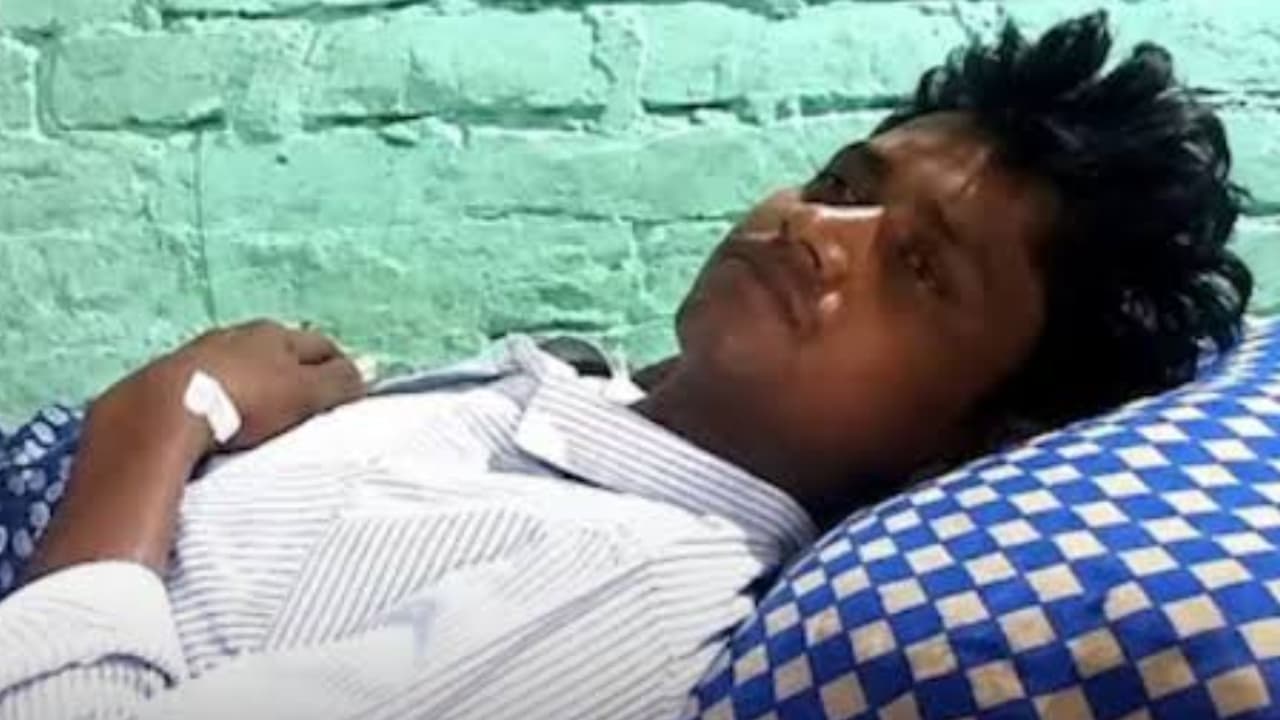 Kanpur man gets 55 stitches after sister in law bites Kanpur man gets 55 stitches after sister in law bites
