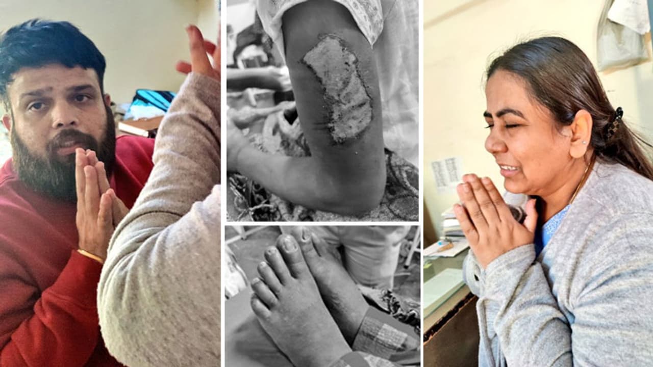 Horrific picture of mental and physical abuse Horrific picture of mental and physical abuse