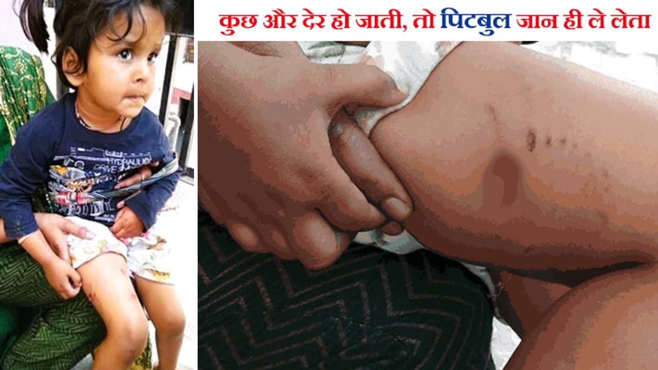 Pitbull dog attack Ambala