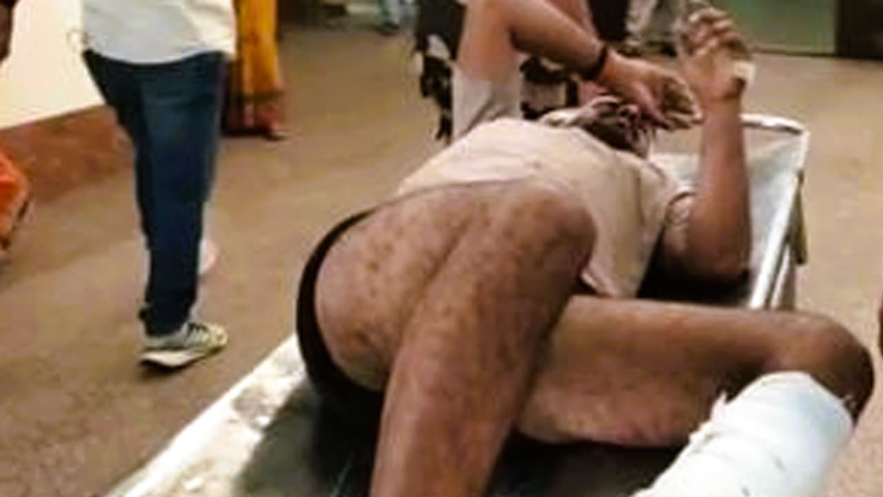 Lepa village shootout