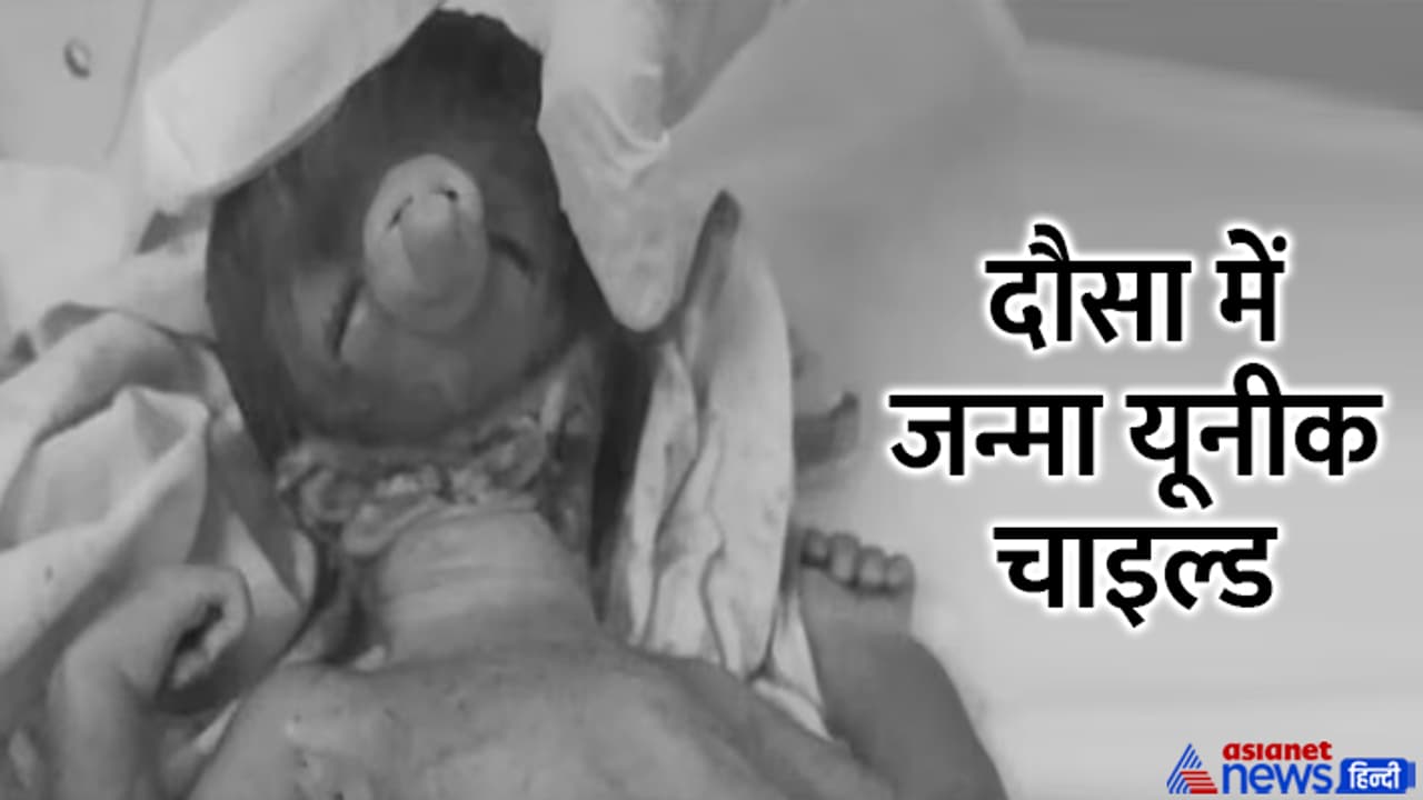 Ganpati like child born in dausa rajasthan Ganpati like child born in dausa rajasthan