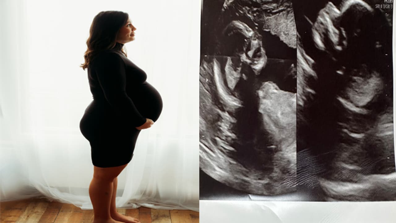 two uteruses gets pregnant two uteruses gets pregnant