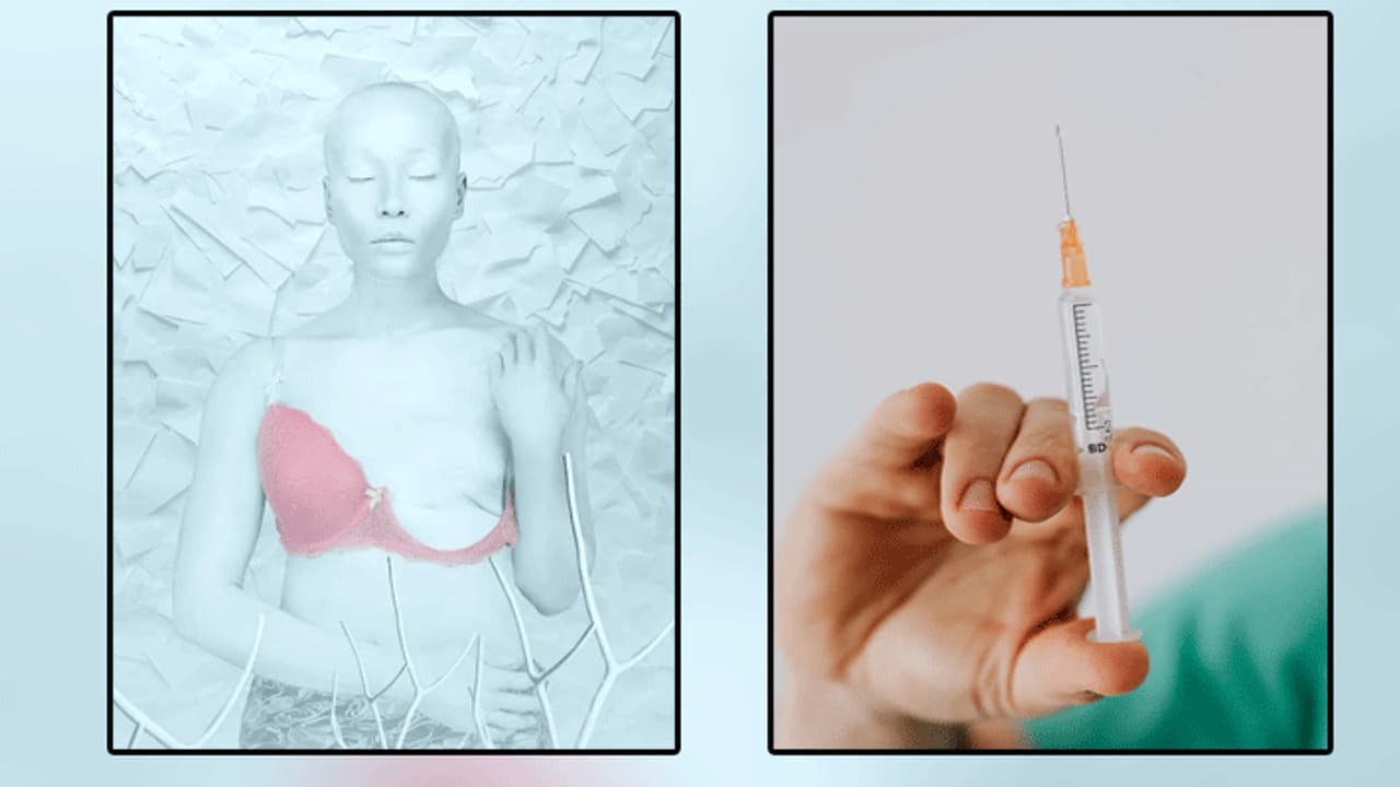 Breast cancer Breast cancer