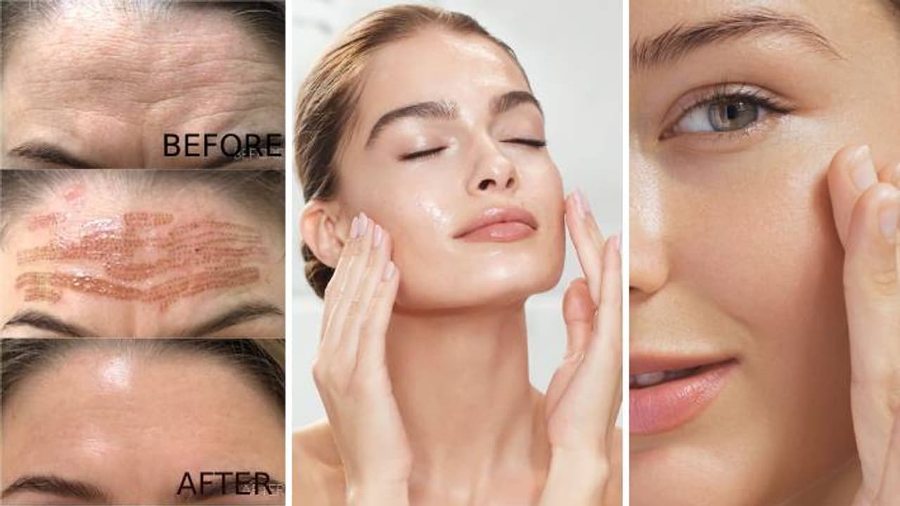 Skin Tightening Home Remedies