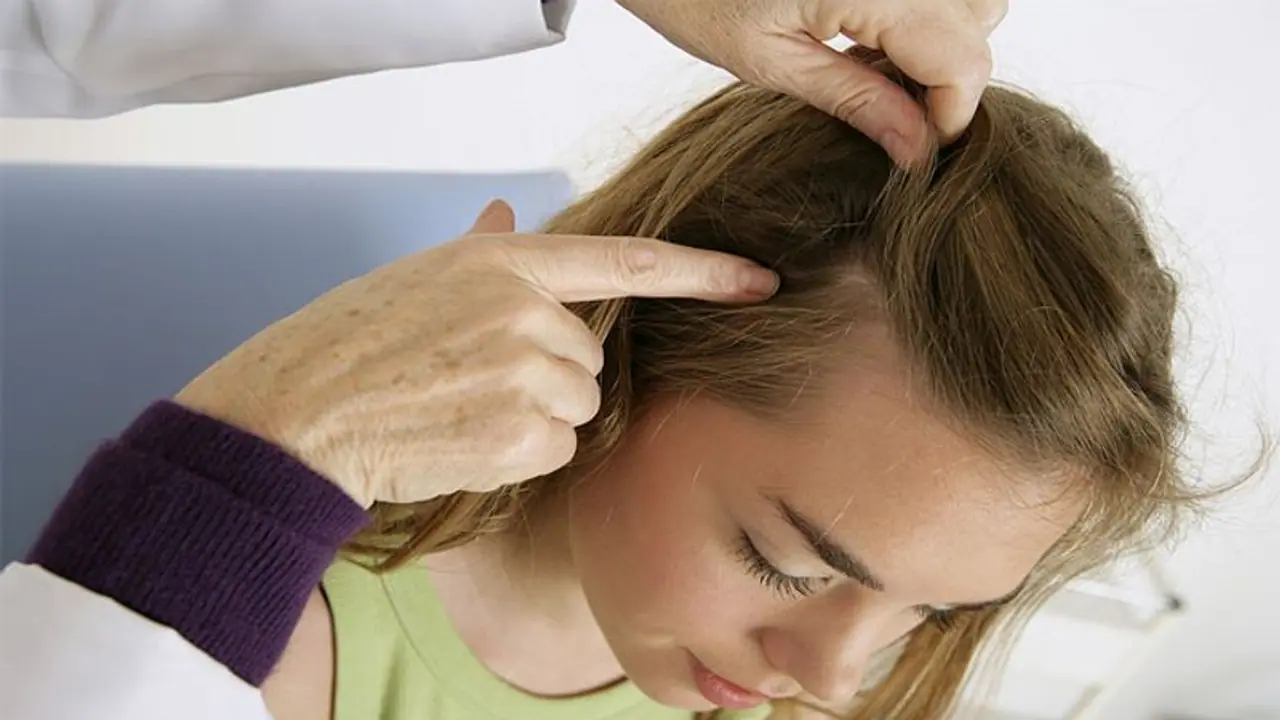 how to get rid from dandruff how to get rid from dandruff