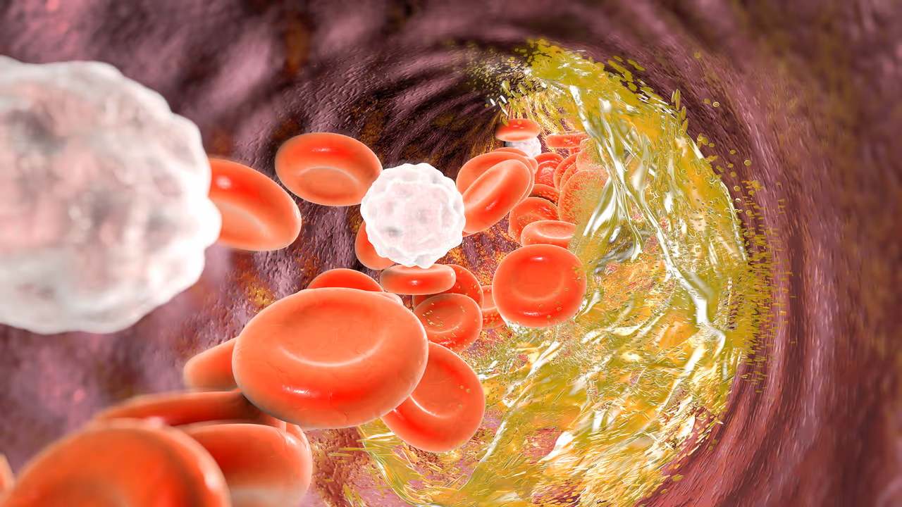 What is cholesterol What is cholesterol