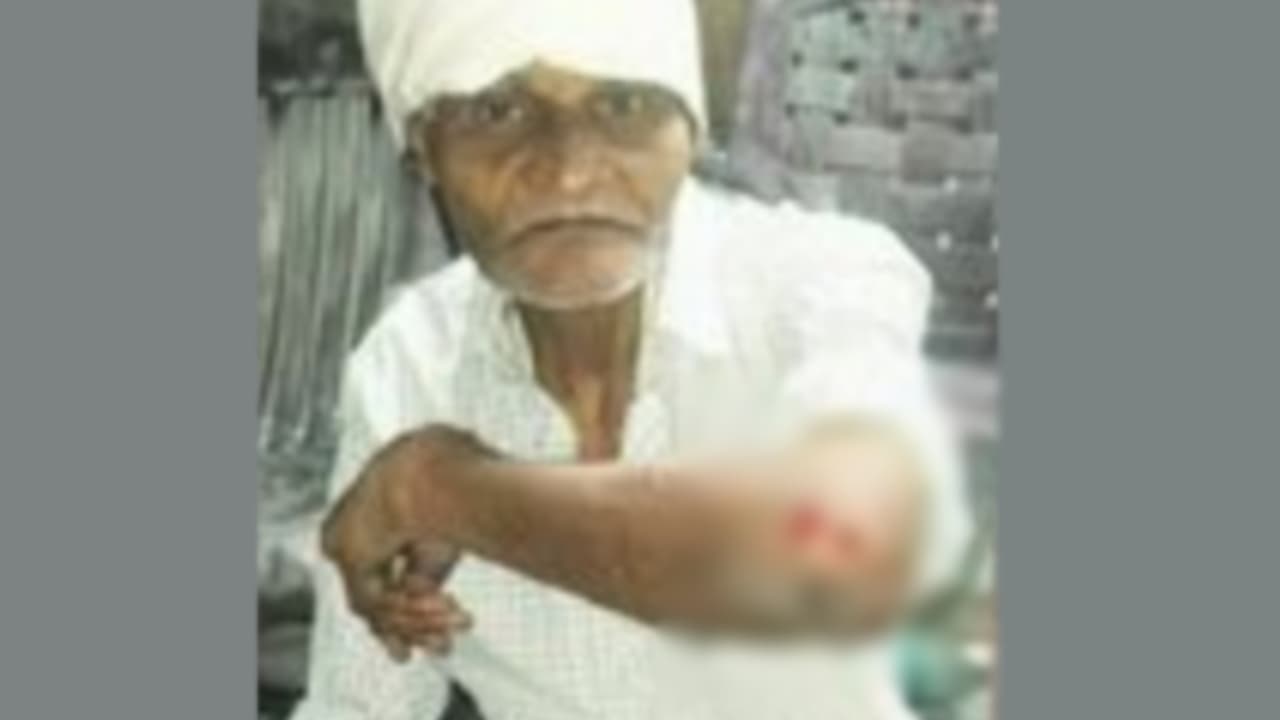 old man injured old man injured