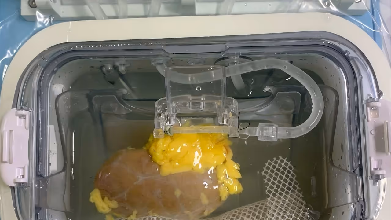 Scientists prepare a donor kidney in the lab for universal transplant use