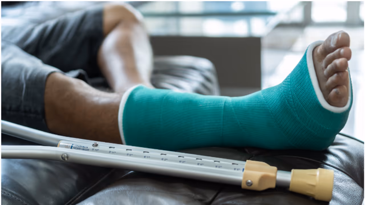 broken leg broken leg