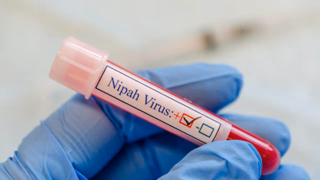 nipah virus spread causes prevention