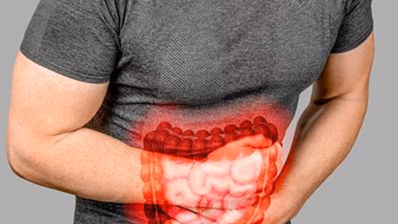 irritable bowel syndrome irritable bowel syndrome