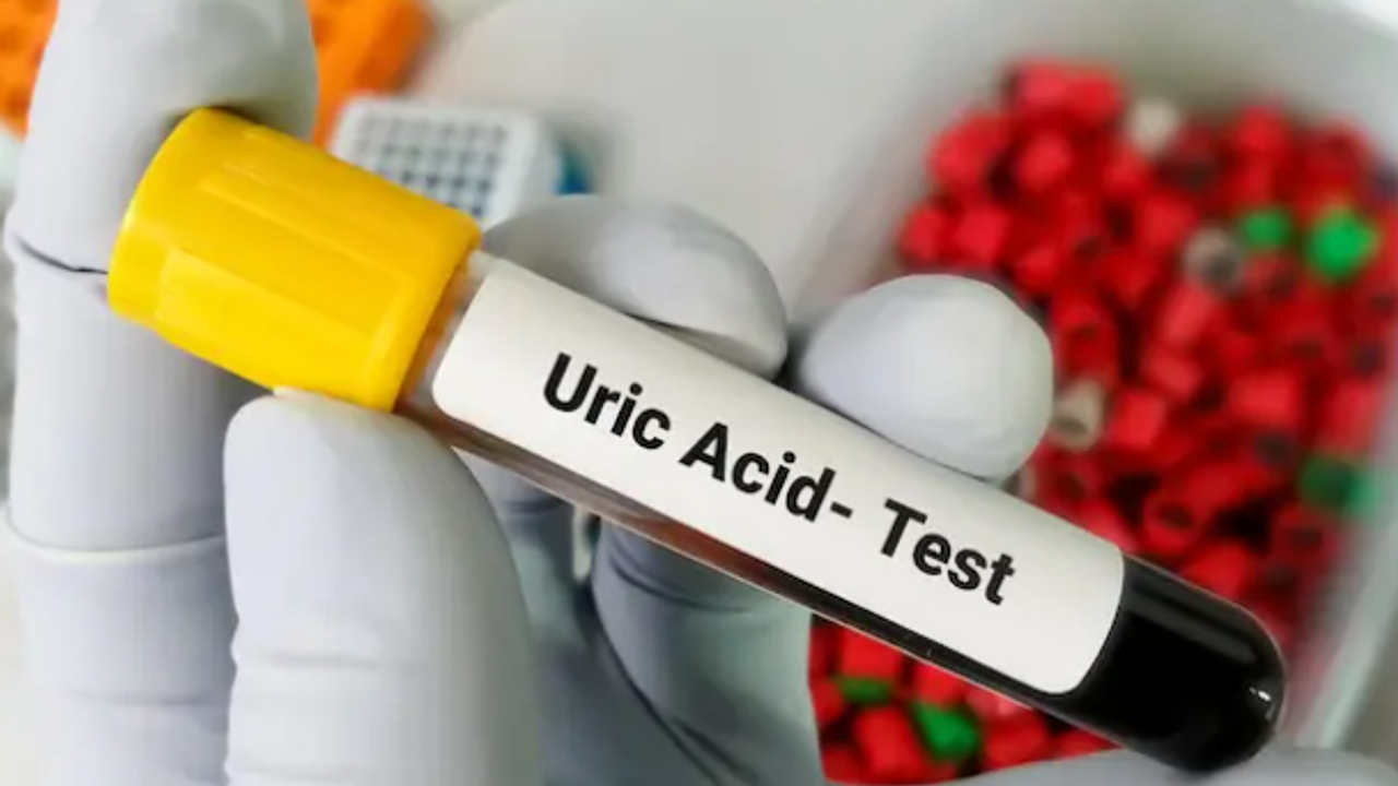 uric acid uric acid