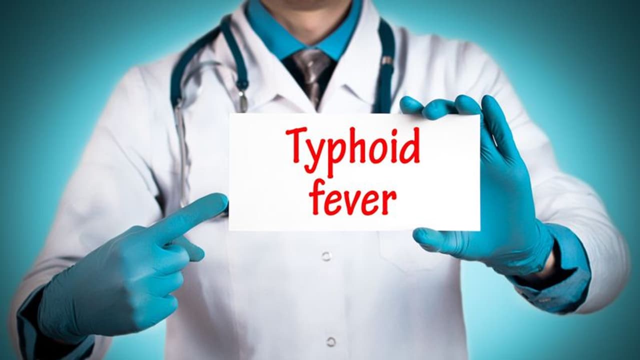 typhoid fever