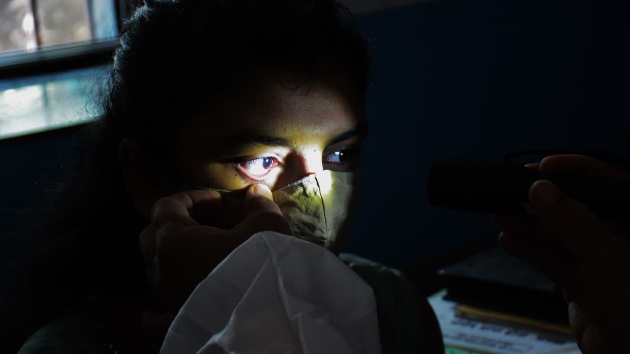 eye infection eye infection