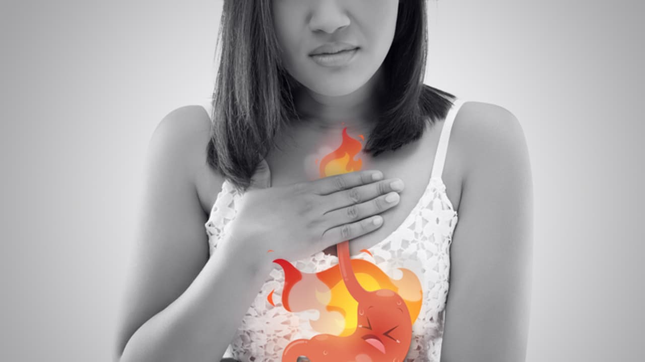gastric or heartburn problem gastric or heartburn problem