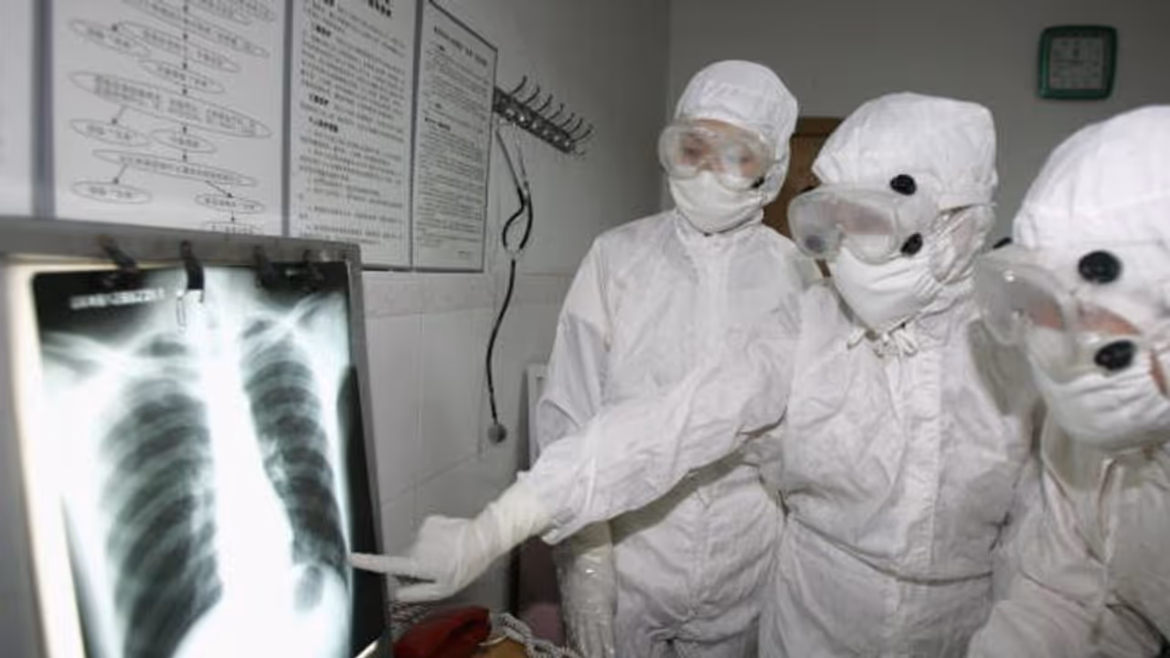 Ebola Ebola