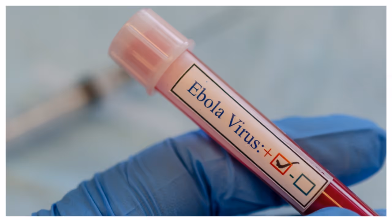Bengaluru Ebola Case Bengaluru Ebola Case