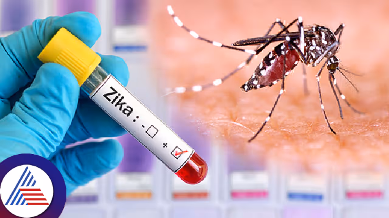 Zika virus Zika virus
