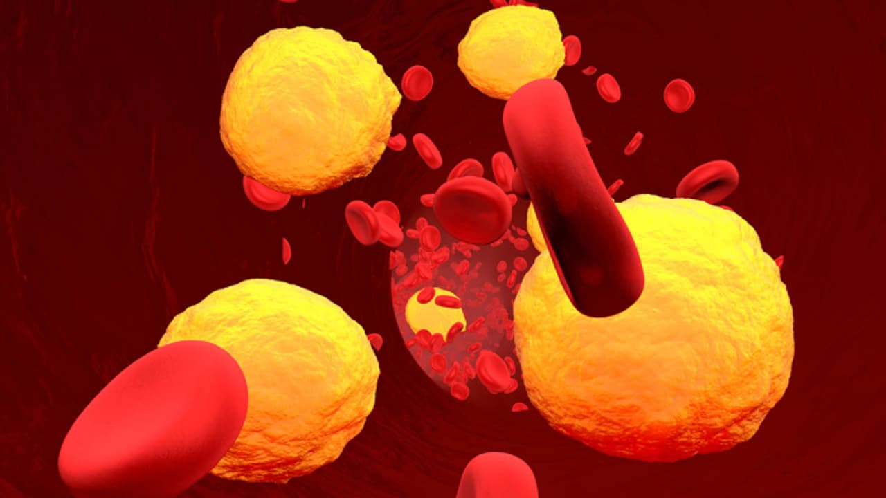 cholesterol cholesterol