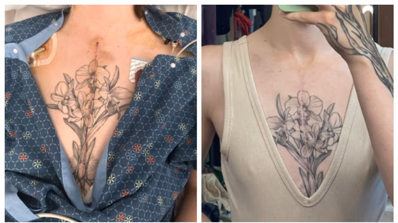 Open heart surgery image by anna Open heart surgery image by anna