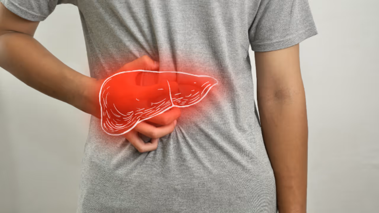 non alcoholic fatty liver disease