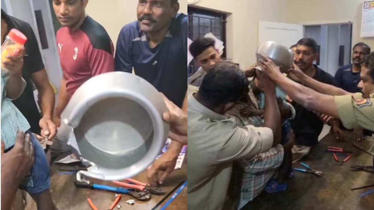 two and half year old head stuck in aluminum pot two and half year old head stuck in aluminum pot
