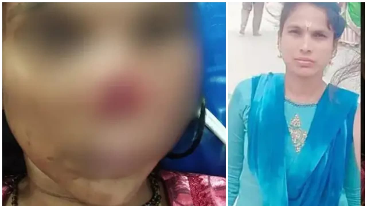 wife nose bite wife nose bite